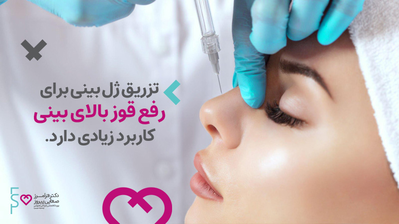 فیلر بینی | تزریق ژل بینی