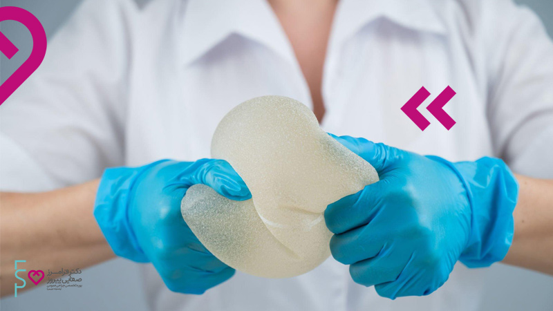 پروتز سینه و شیردهی - هر آنچه که باید درباره عوارض پروتز سینه و شیردهی دانست 4 پروتز سینه و بارداری | پروتز سینه و شیردهی