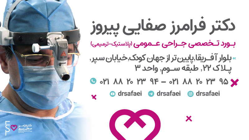 دکتر صفایی | عمل جراحی پلک مغولی