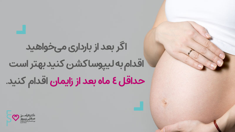 لیپوساکشن بعد از بارداری