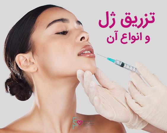تزریق ژل و انواع آن