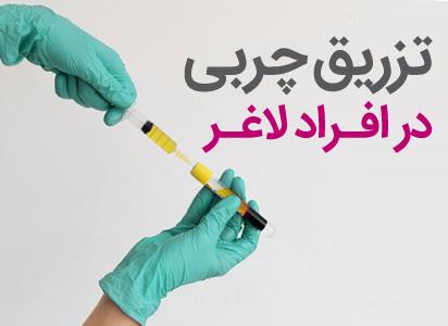 تزریق چربی در افراد لاغر