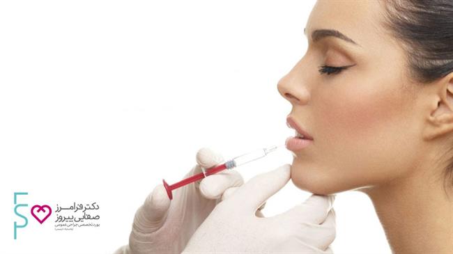 هزینه و قیمت تزریق ژل لب ژوویدرم