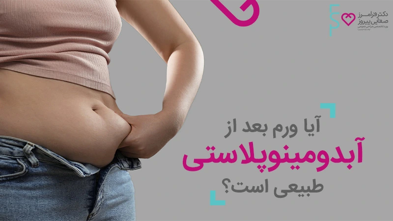 آیا ورم بعد از آبدومینوپلاستی طبیعی است ؟