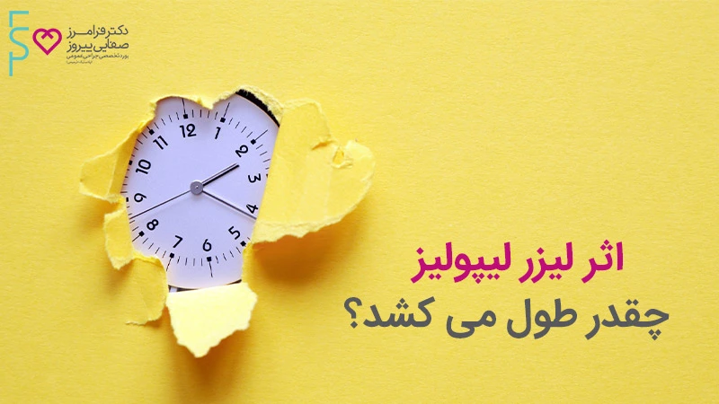 اثر لیزر لیپولیز چقدر طول می کشد