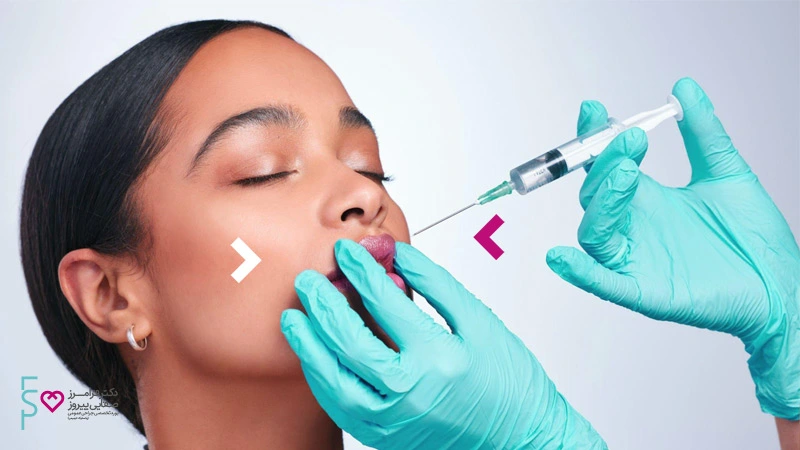 تزریق ژل و انواع آن