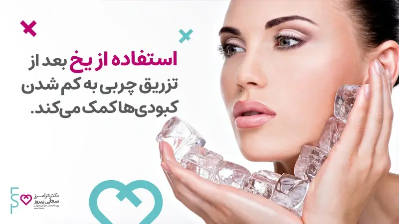 استفاده از یخ برای کبودی صورت بعد از تزریق چربی