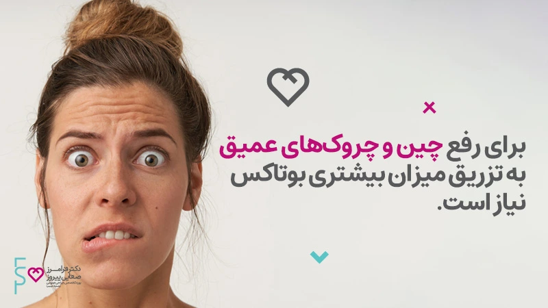 چقدر بوتاکس نیاز دارم؟