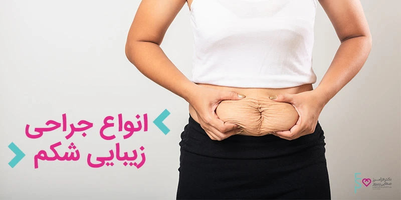 انواع عمل زیبایی شکم