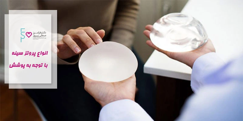 انواع پروتز سینه با توجه به پوشش