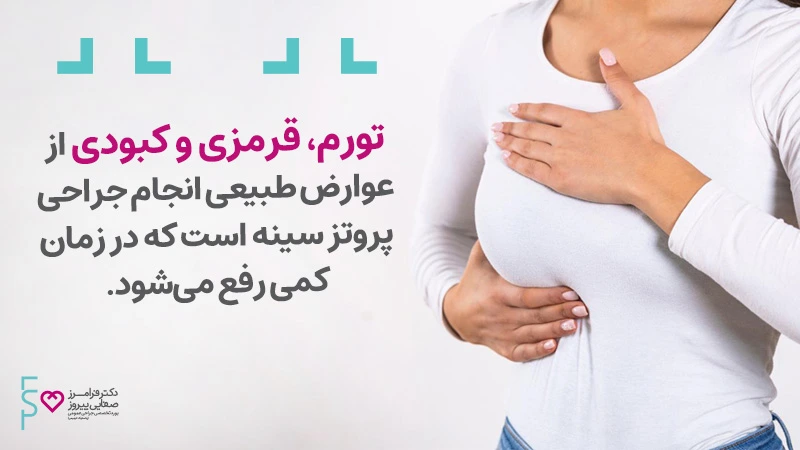 سوالات متداول پروتز سینه