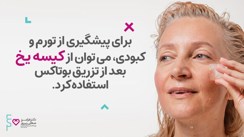 مراقبت های بعد از تزریق بوتاکس