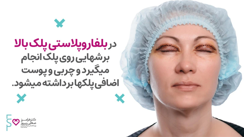 بلفاروپلاستی پلک بالا
