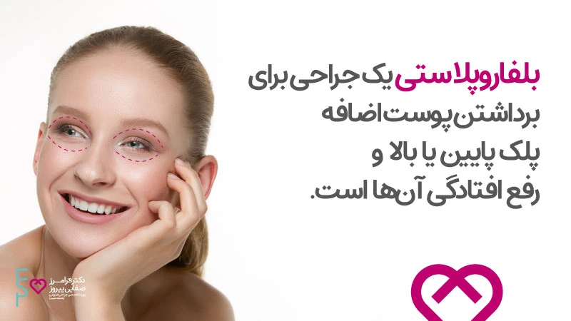 بلفاروپلاستی چیست؟ همه چیز درباره عمل بلفاروپلاستی