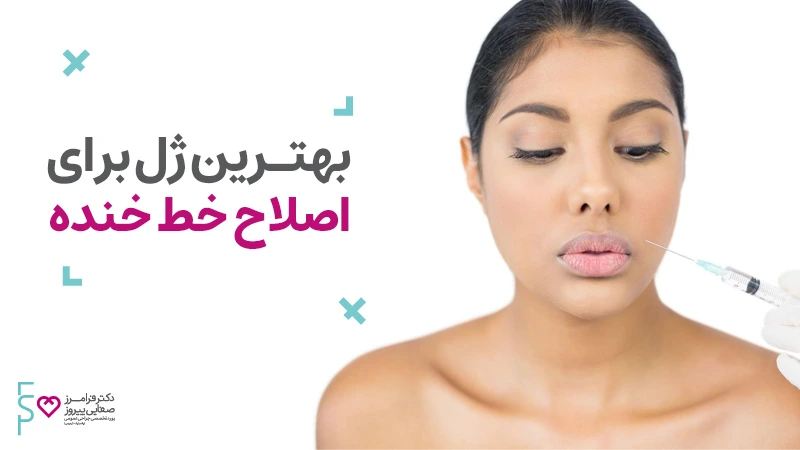 بهترین ژل برای خط خنده