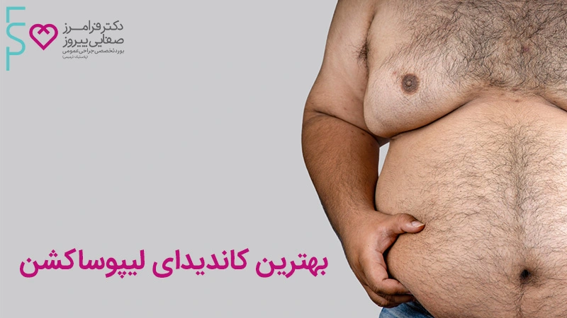 پیکرتراشی برای چه کسانی مناسب است؟