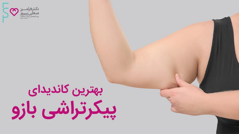 بهترین کاندیدای پیکرتراشی بازو
