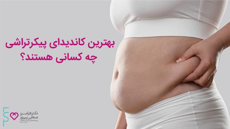 بهترین کاندیدای پیکرتراشی چه کسانی هستند