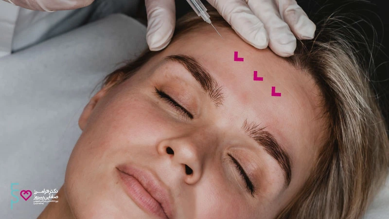 بوتاکس دیسپورت چیست