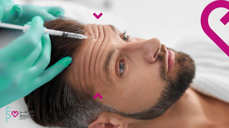 در مورد بوتاکس بیشتر بدانید | بوتاکس و انواع رایج آن در بازار
