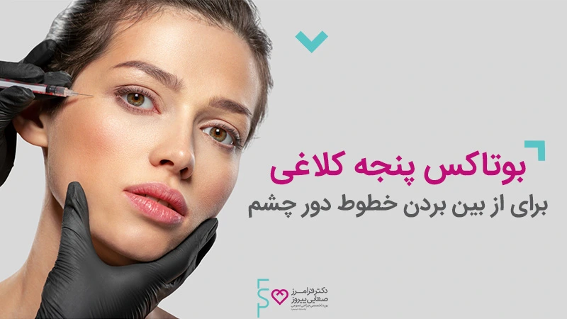 تزریق بوتاکس پنجه کلاغی