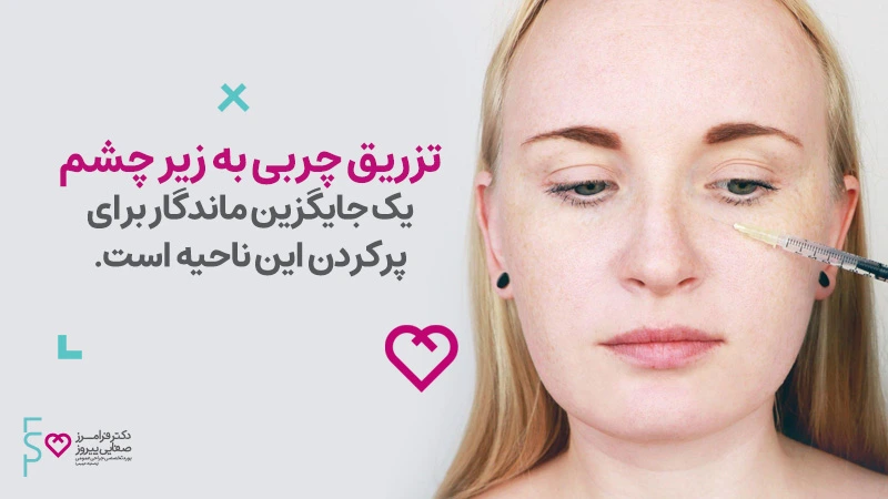 تزریق چربی به زیر چشم