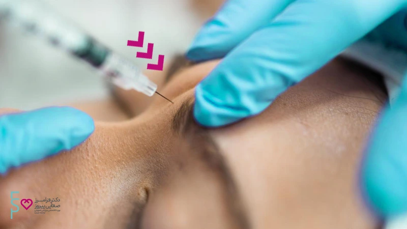 بهترین روش های رفع چین و چروک پیشانی