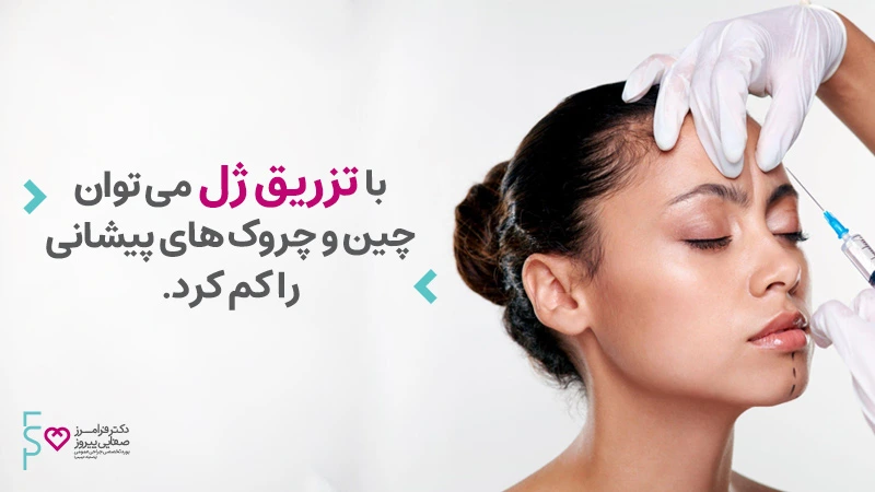 تزریق ژل برای چروک پیشانی