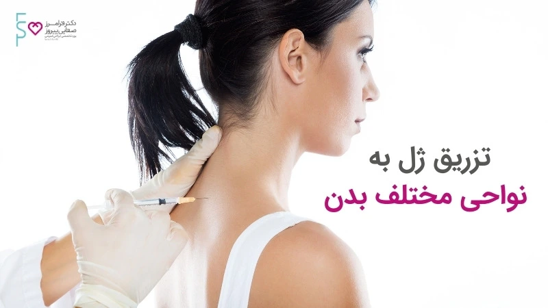 تزریق ژل و انواع آن