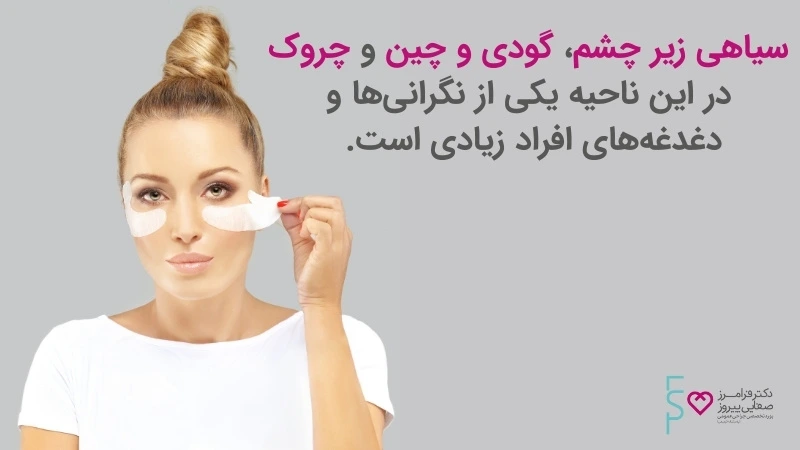 تزریق ژل زیر چشم