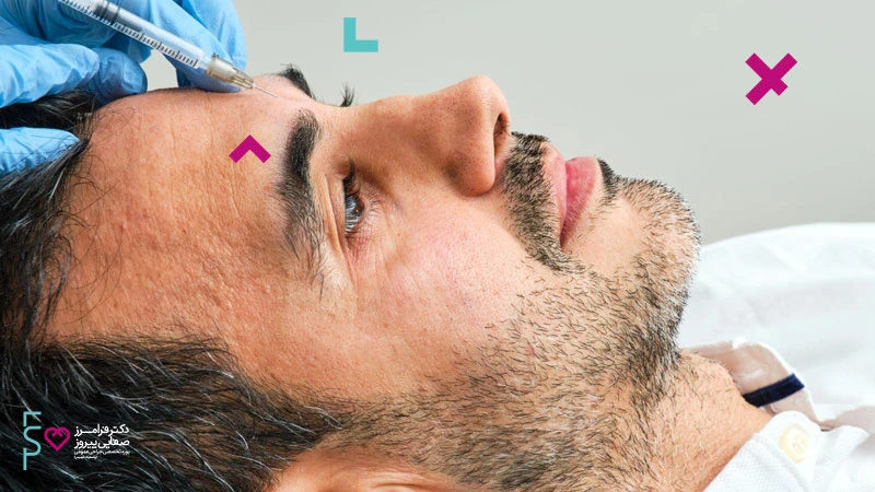 تزریق ژل صورت انواع ژل صورت