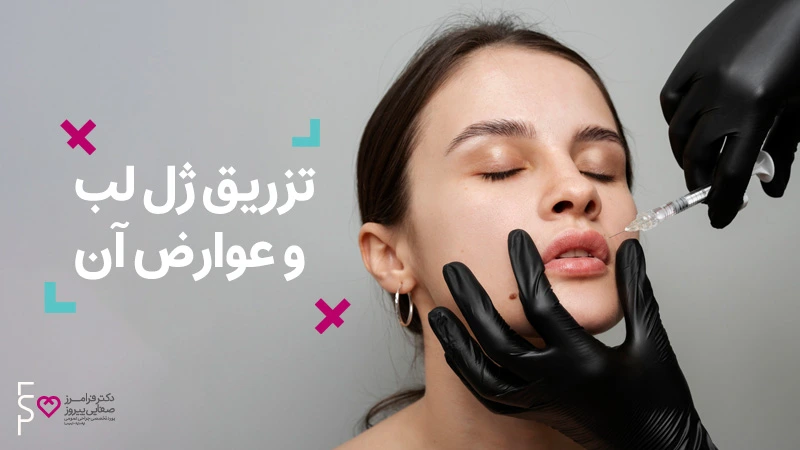تزریق ژل لب و عوارض آن