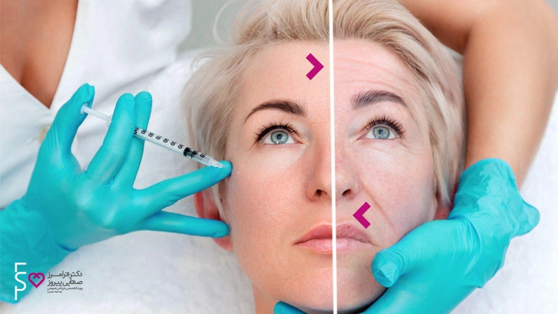 توصیه های قبل از تزریق ژل