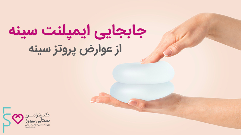 جا به جایی ایمپلنت سینه از عوارض پروتز سینه