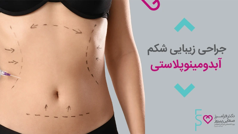 جراحی زیبایی شکم آبدومینوپلاستی