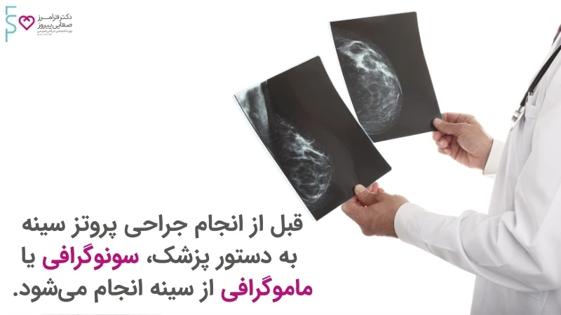 پروتز سینه - آنچه که باید در مورد جراحی پروتز سینه بدانیم