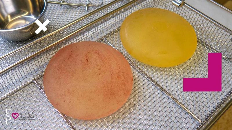 آنچه که باید در مورد ALCL و پروتز سینه بدانید