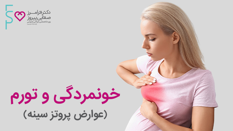 خونمردگی و تورم عوارض پروتز سینه