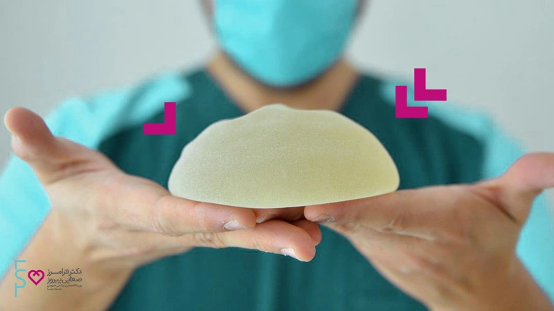 در چه صورت می توان پروتز سینه را تعویض نمود