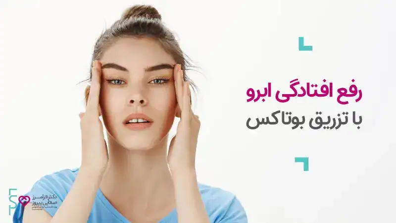 درمان افتادگی ابرو بعد از بوتاکس