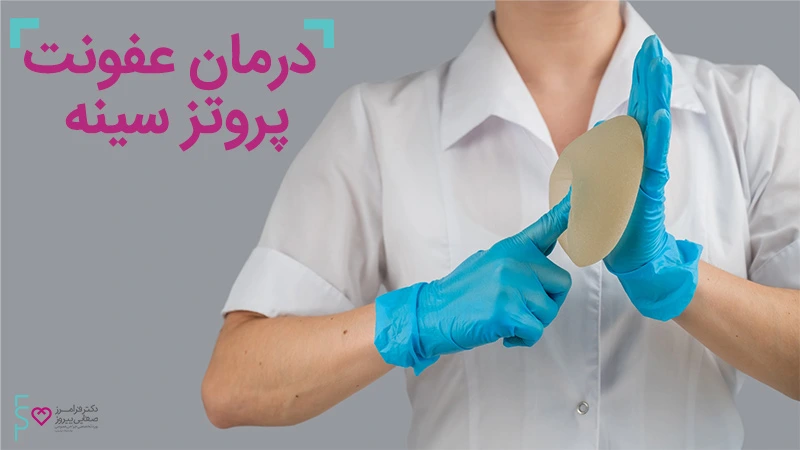عفونت پروتز سینه و علل آن