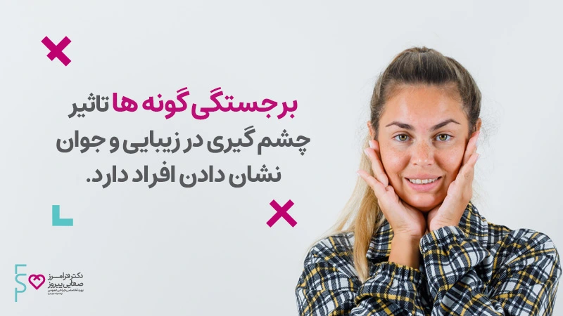 تزریق ژل گونه یا گونه‌گذاری با استفاده از ژل ژوویدرم