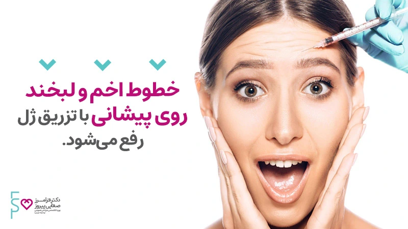 رفع خطوط اخم و لبخند پیشانی با تزریق ژل
