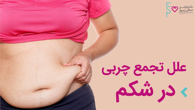 علت تجمع چربی در شکم