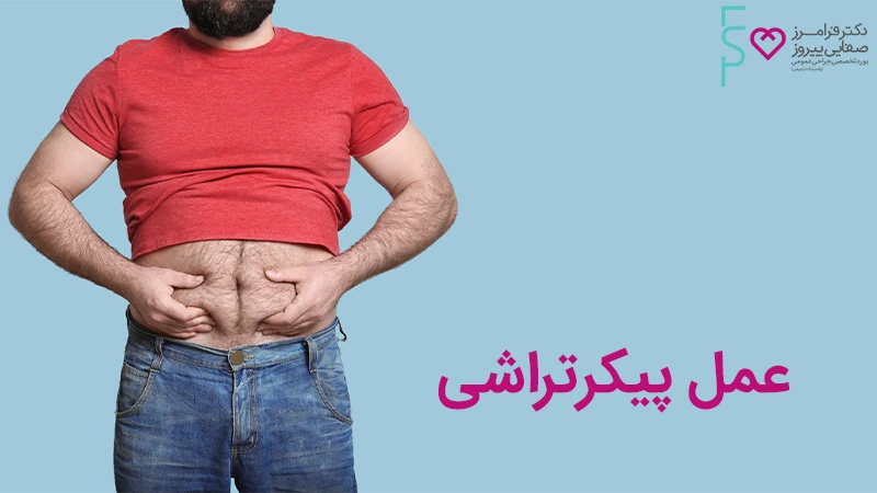 هزینه عمل پیکرتراشی