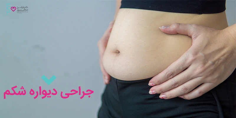 عمل دیواره شکم