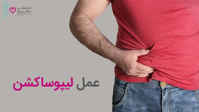 عمل لیپوساکشن