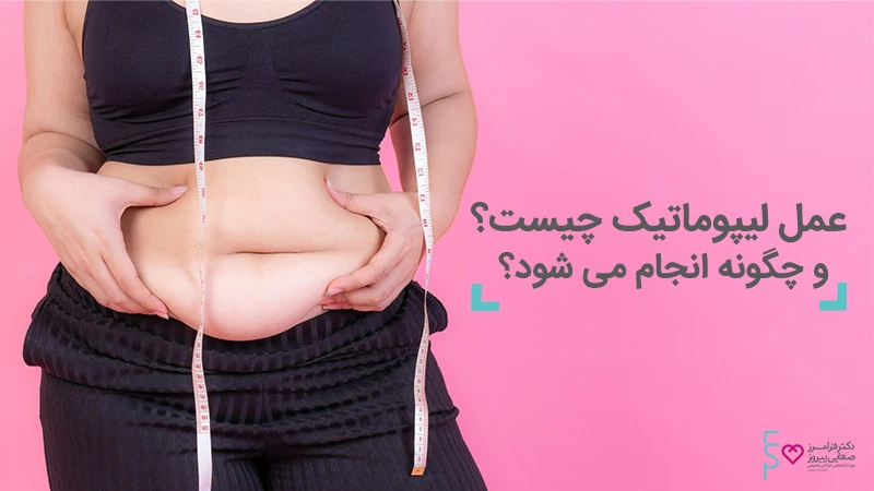 عمل لیپوماتیک چگونه انجام می شود