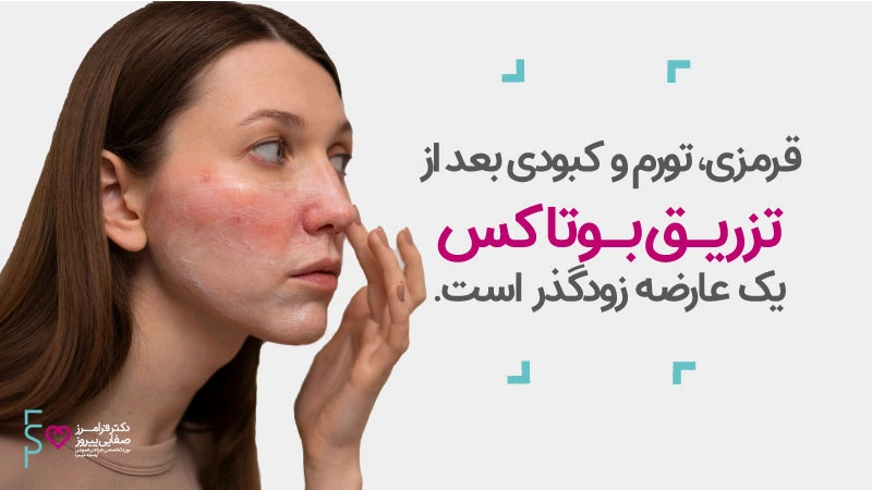 عوارض بوتاکس فک و چانه