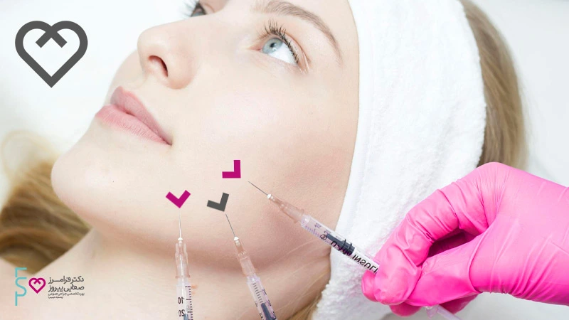 هرآنچه نیاز است درباره تزریق ژل آلیاکسین بدانید